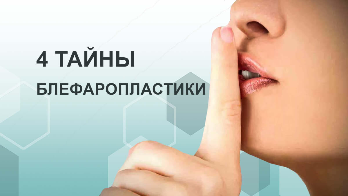 4 тайны блефаропластики