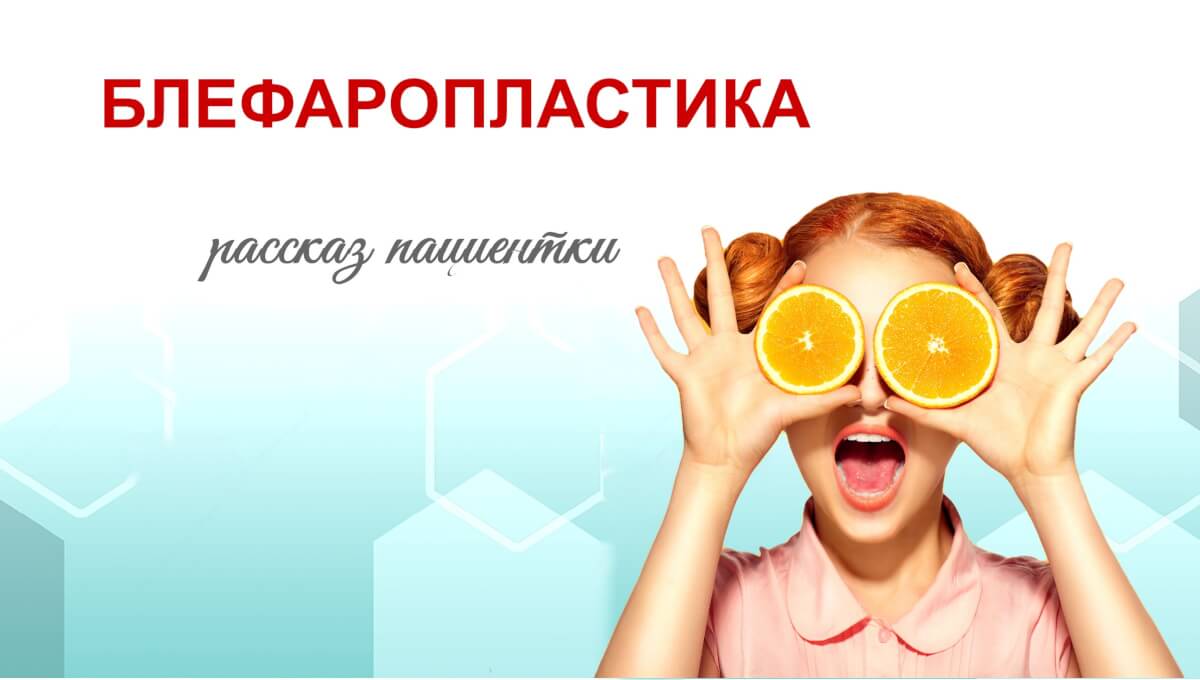 Блефаропластика. Рассказ пациентки
