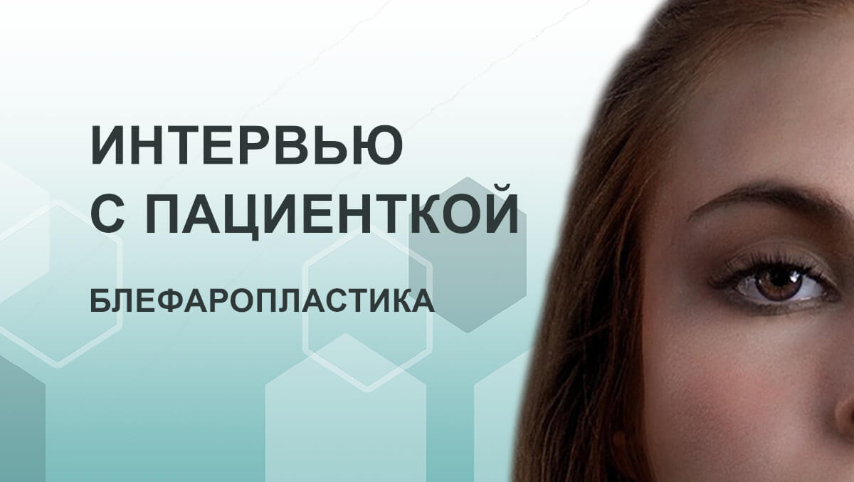Блефаропластика, интервью с пациенткой
