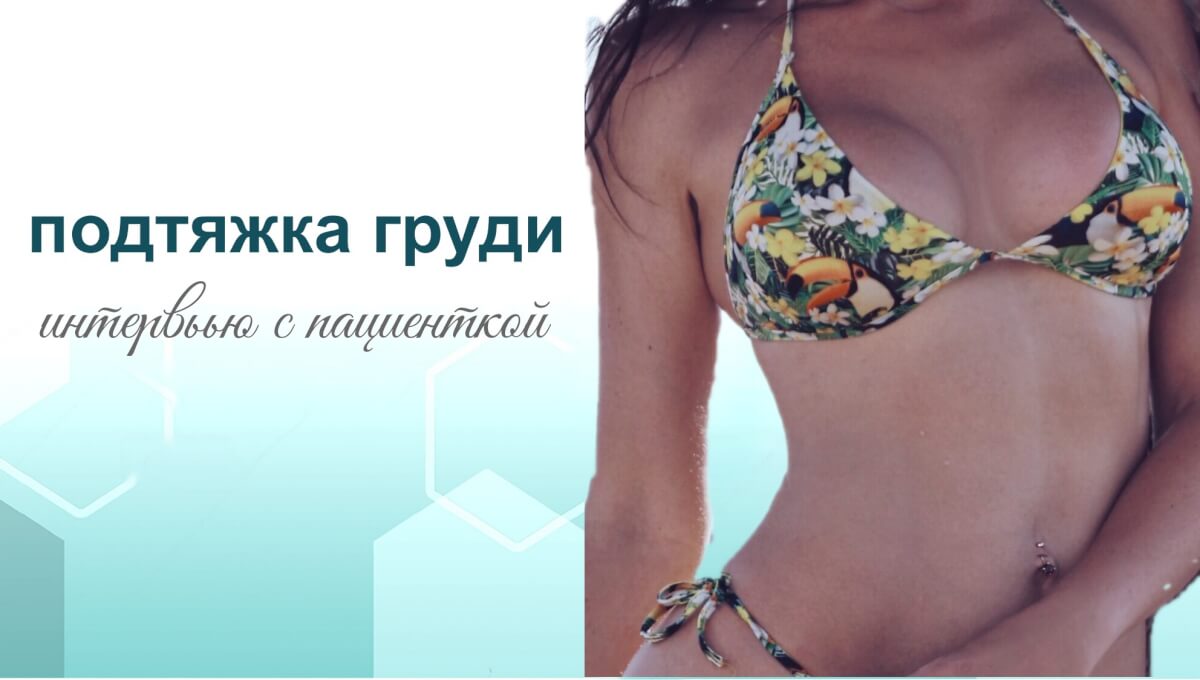 Подтяжка груди. Интервью с пациенткой